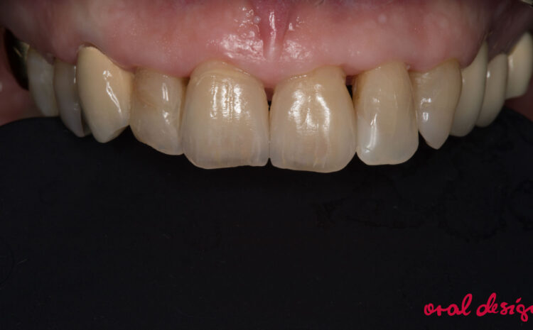 Zweiteilige Kursreihe: High Performance with  Creation ZI-CT Teil 2 (Fortgeschrittene)