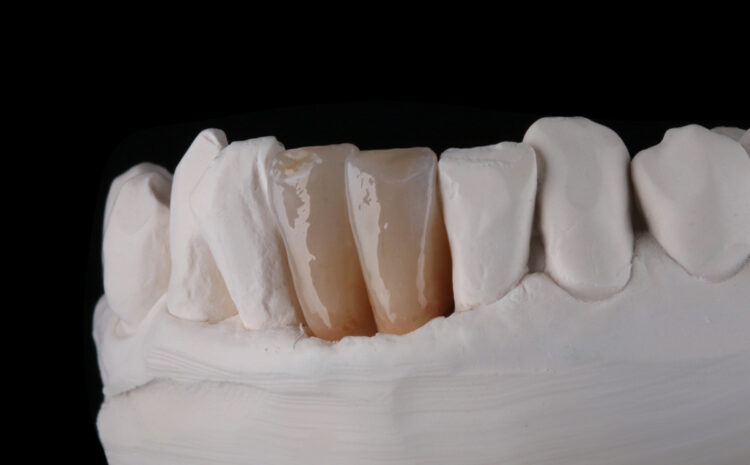 Zweiteilige Kursreihe: High Performance with  Creation ZI-CT Teil 2 (Fortgeschrittene)